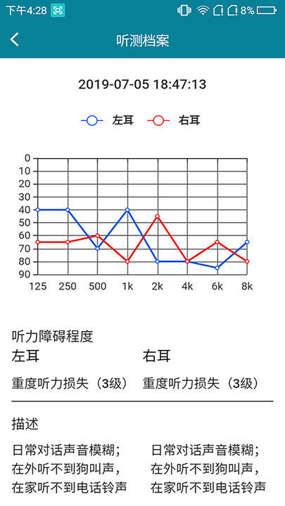 亿耳助听(1)